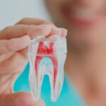 Endodoncia en San Pedro de Alcántara | Clínica dental Ana Moreno